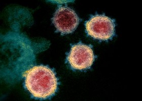 Naukowcy pracują nad powłoką zabijającą koronawirusa