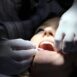 nanopowłoka implanty dentystyczne